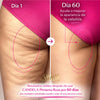 Nueva CANDELA™ - Tu aliada contra la apariencia de estrías y celulitis ✨