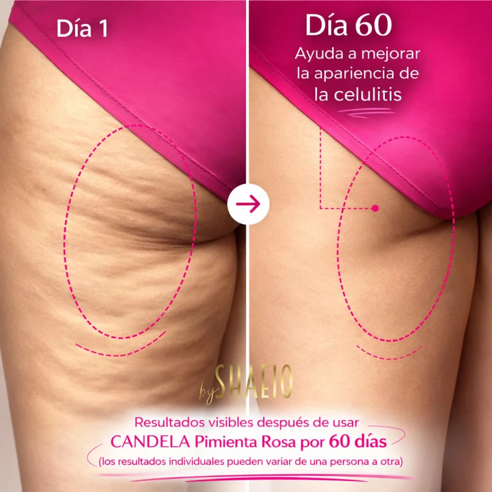 Nueva CANDELA™ - Tu aliada contra la apariencia de estrías y celulitis ✨