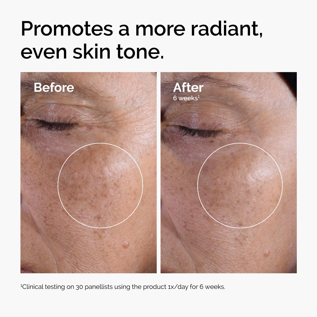 Nuevo The Ordinary Tratamiento para Cuidado Diario + 🎁 Regalo Incluido
