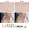 Nuevo Spray Exfoliante Corporal Dr. Melaxin Peel Shot para Manchas, Textura y Piel Áspera ✨ - BUSTEO STORE