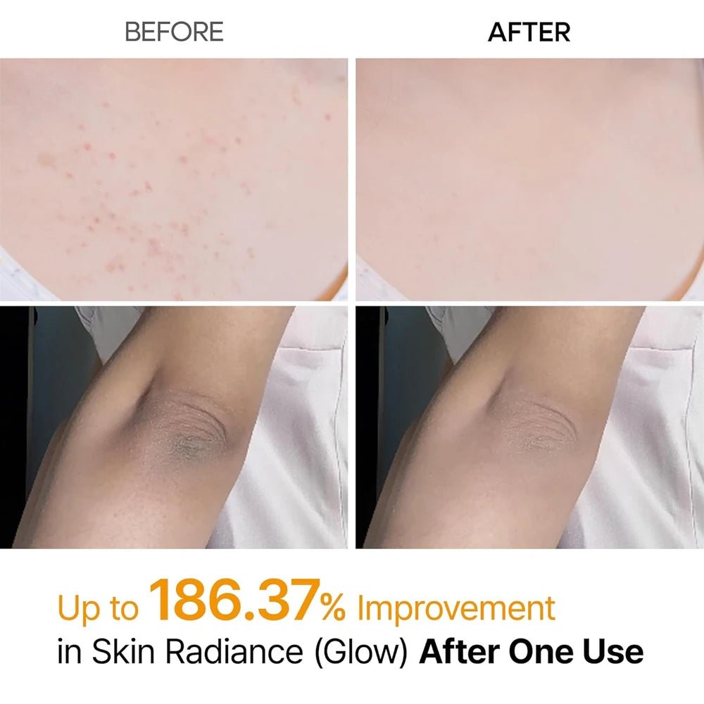Nuevo Spray Exfoliante Corporal Dr. Melaxin Peel Shot para Manchas, Textura y Piel Áspera ✨ - BUSTEO STORE
