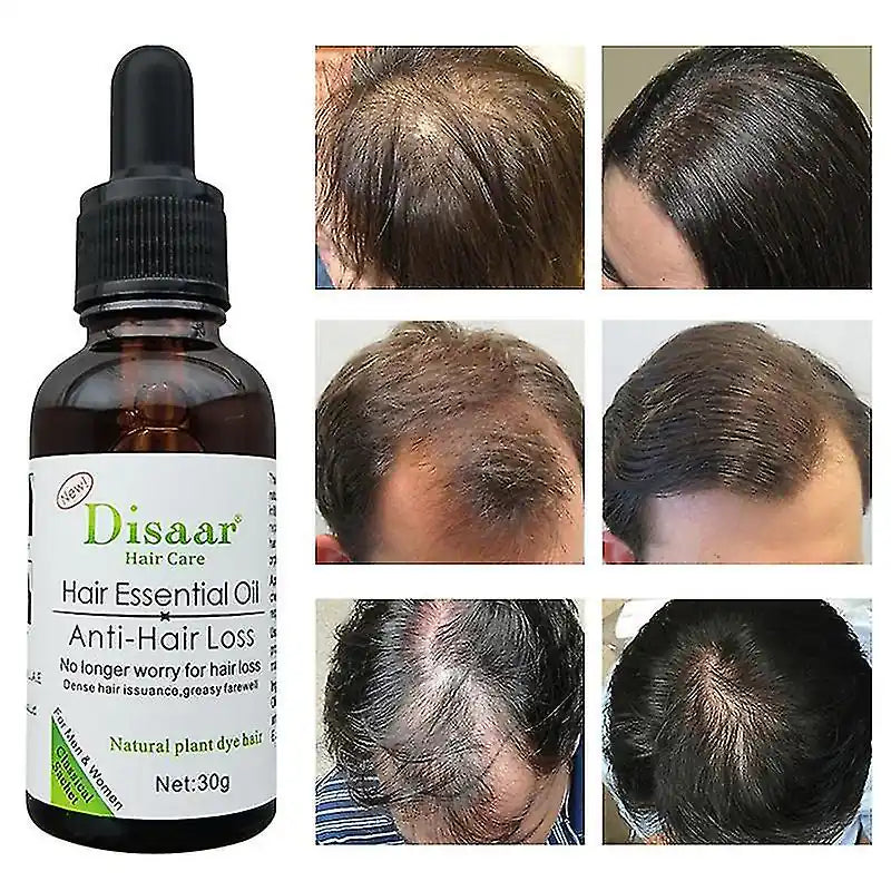 Nuevo Tratamiento Capilar Anticaída y Reparador Disaar ✨ - BUSTEO STORE